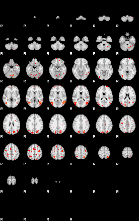 Patients 28941 99