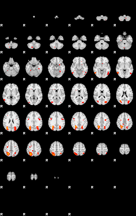 Patients 29189 163