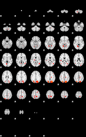 Patients 29657 32