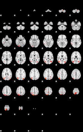 Patients 29732 2