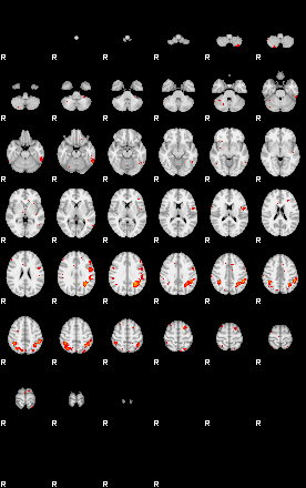 Patients 29053 128