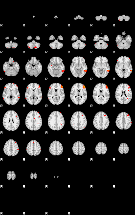 Patients 29113 29