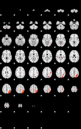 Patients 29162 35