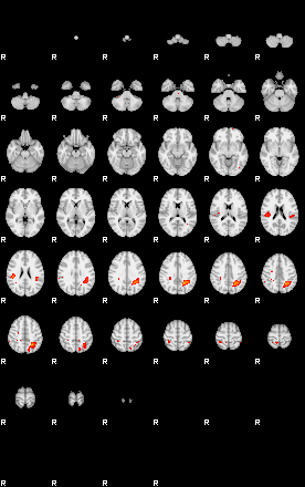 Patients 29171 70