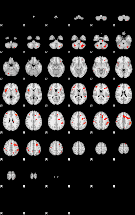 Patients 29191 177