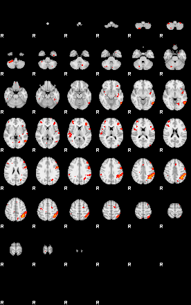 Patients 29203 10