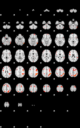 Patients 30001 97