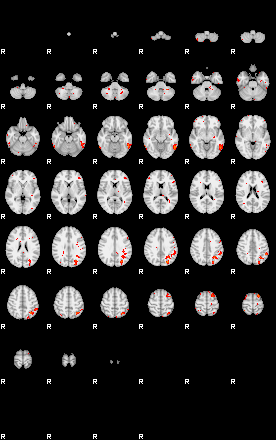 Patients 30018 11