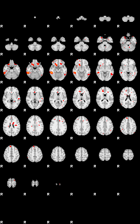 Patients 29172 199