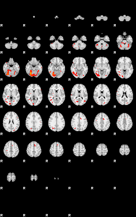 Patients 29100 4