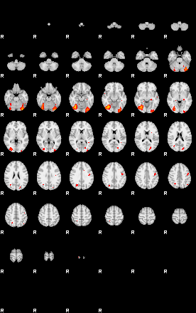 Patients 29168 163