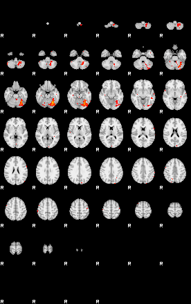 Patients 29881 23