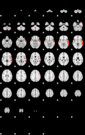 Patients 28815 96