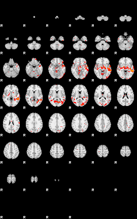 Patients 29007 99