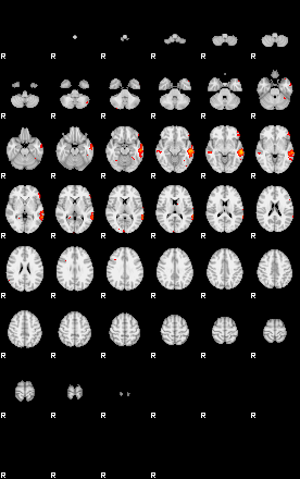 Patients 29065 35