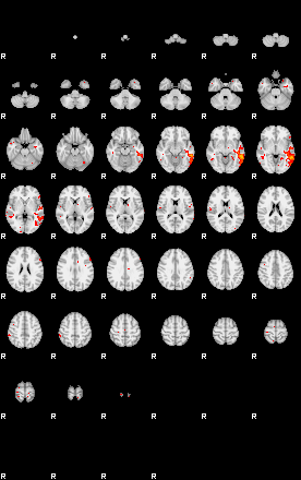 Patients 29291 8