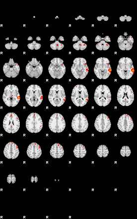 Patients 29511 14