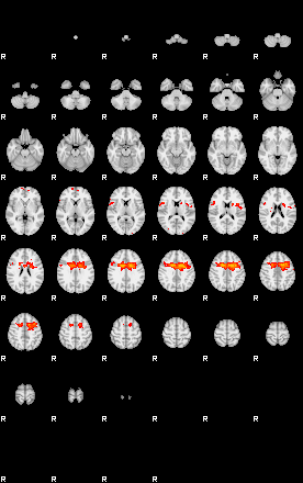 Patients 28818 6