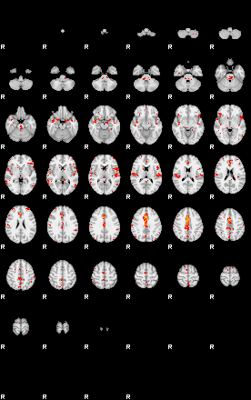 Patients 29012 55