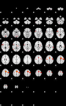 Patients 29099 55