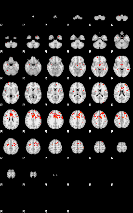 Patients 29503 4