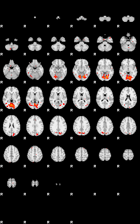 Patients 29030 12