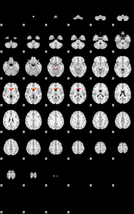 Patients 29161 80