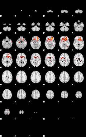 Patients 29176 51