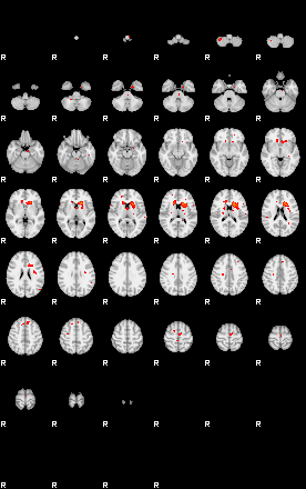 Patients 28817 76