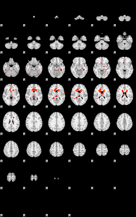 Patients 29175 191