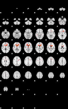 Patients 29208 190