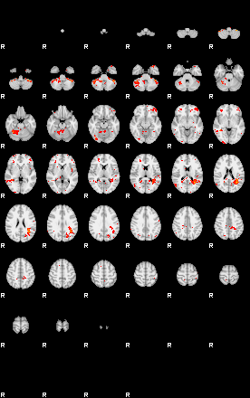 Patients 29506 152