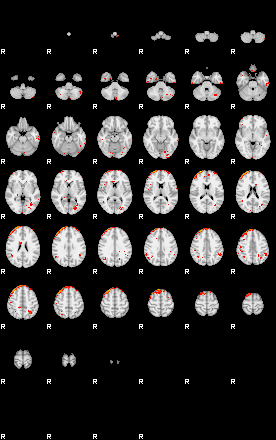 Patients 29008 150