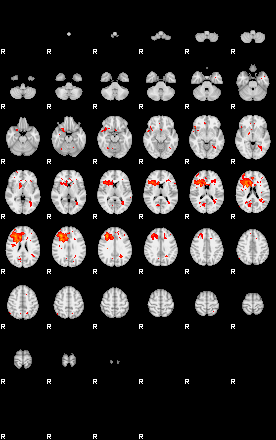 Patients 29151 131