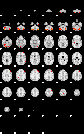 Patients 29025 50