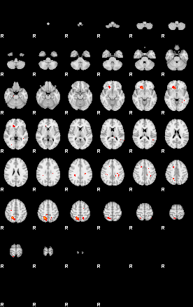 Patients 29161 142