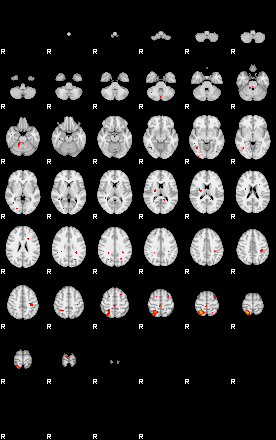 Patients 29170 161