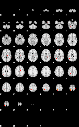 Patients 29172 150