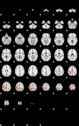 Patients 30180 138