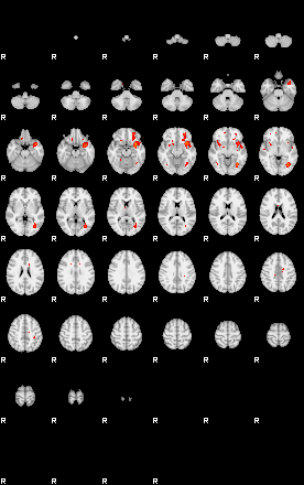 Patients 29063 1