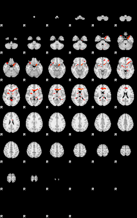 Patients 29069 169