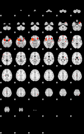 Patients 29176 128