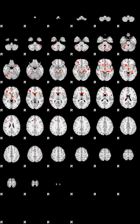 Patients 29508 87