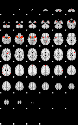 Patients 29667 1