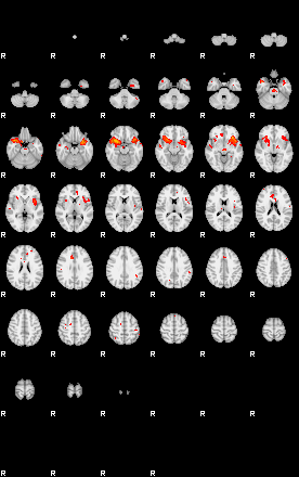 Patients 29217 1