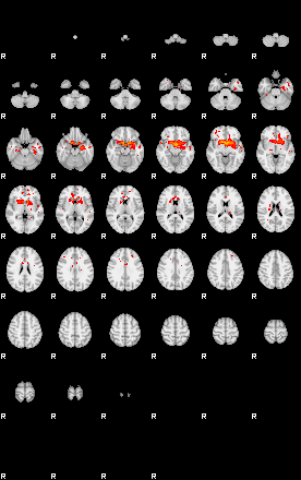 Patients 29180 174