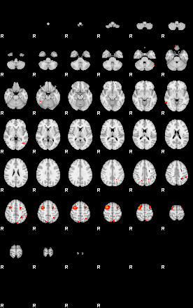 Patients 29164 148