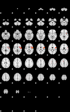 Patients 29070 106