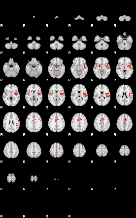 Patients 29167 12