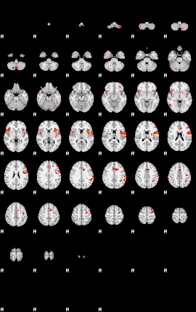 Patients 29188 122